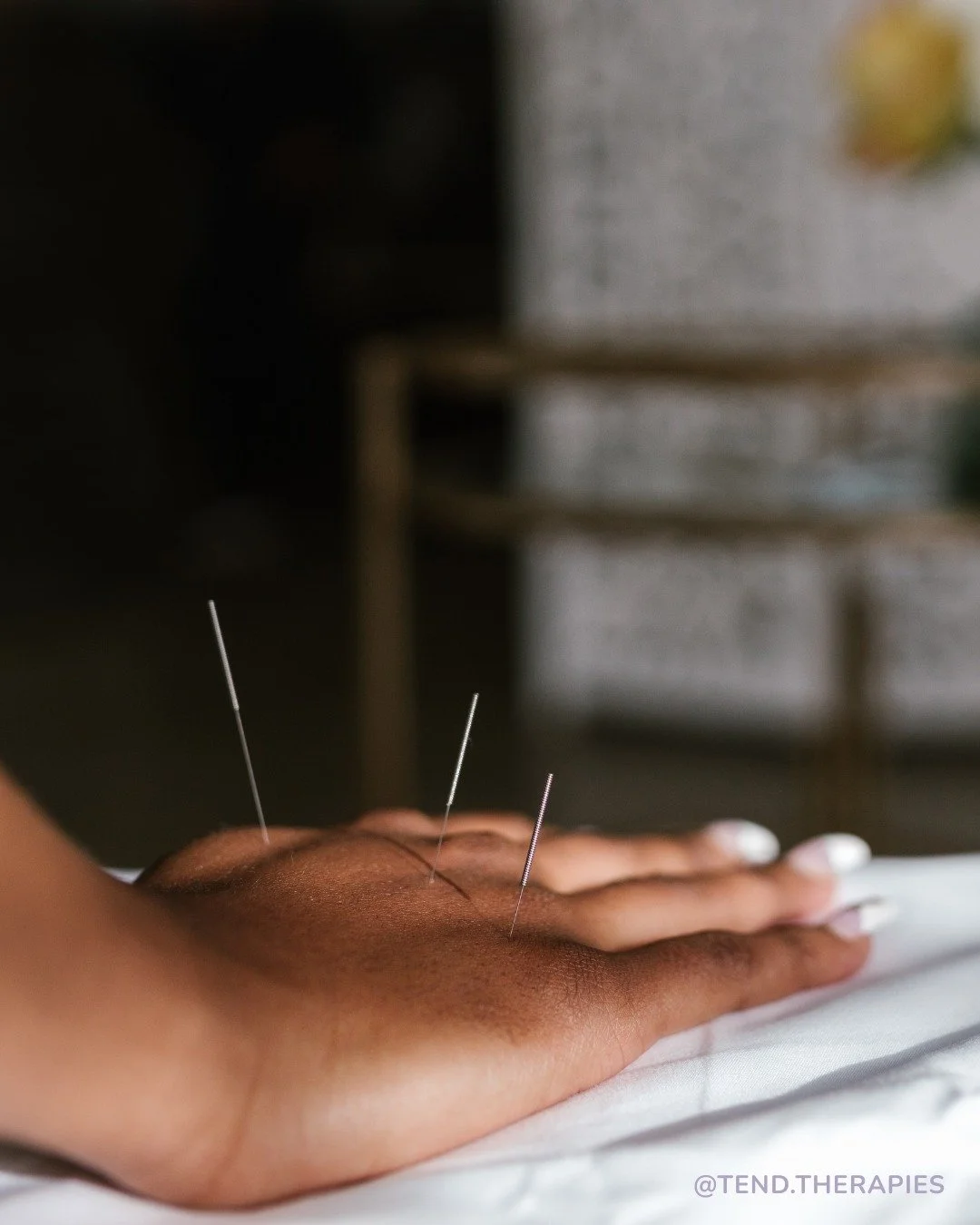 In East Asian medicine, the Five Shu points are some of the most powerful points on the body, and they start from the hands and feet 🙌👣

These points sit along each meridian from the tips of the fingers and toes up to the elbows and knees. Classica