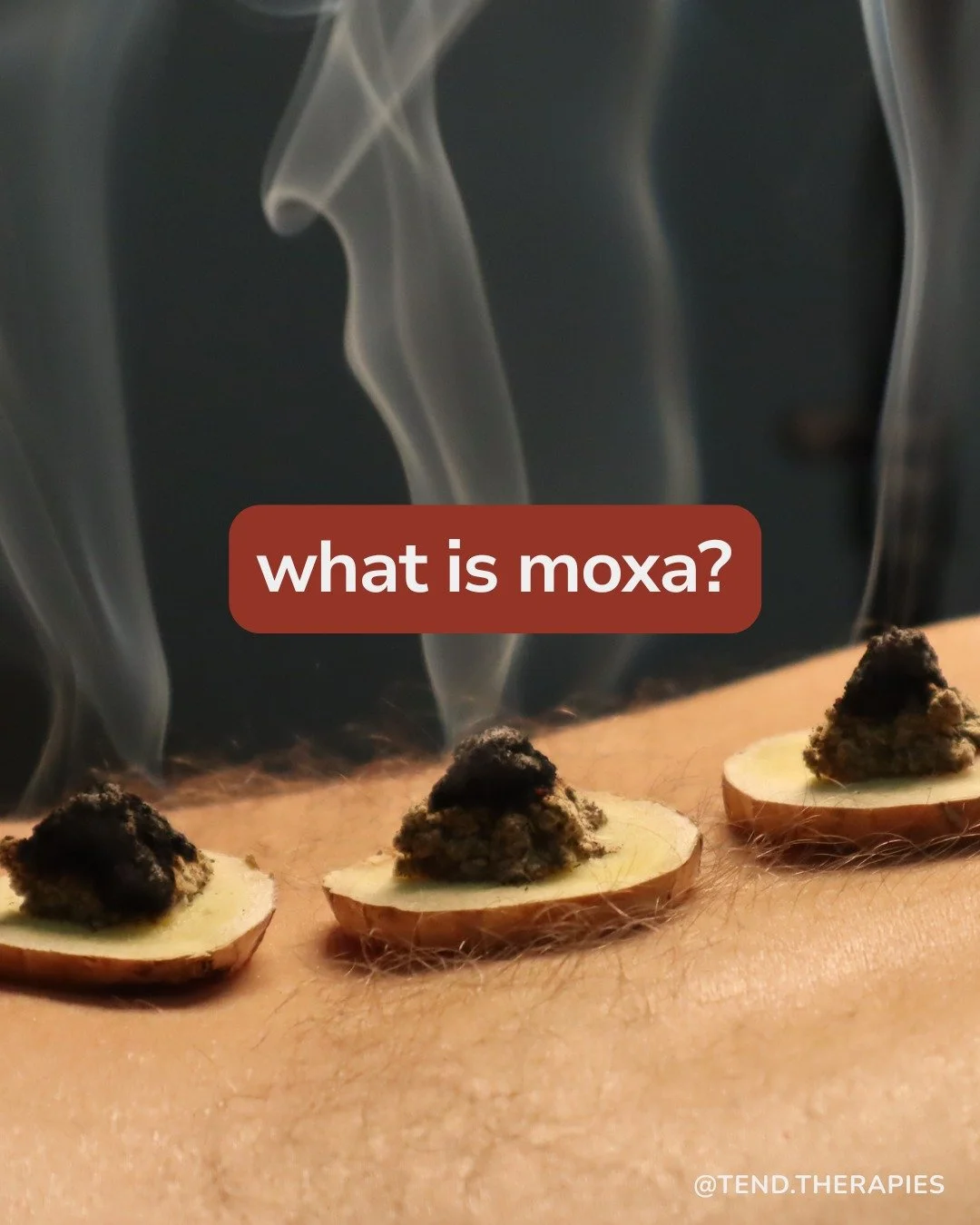 Moxibustion is a traditional therapy that uses the gentle heat of burning mugwort (Ai Ye) to warm and activate acupuncture points. Clinically, it&rsquo;s used to support yang, improve circulation, and help the body move from cold, sluggish, or deplet