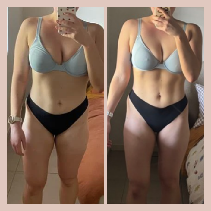 Side-by-side comparison of a woman’s body before and after weight loss, wearing a light blue bra and black underwear.