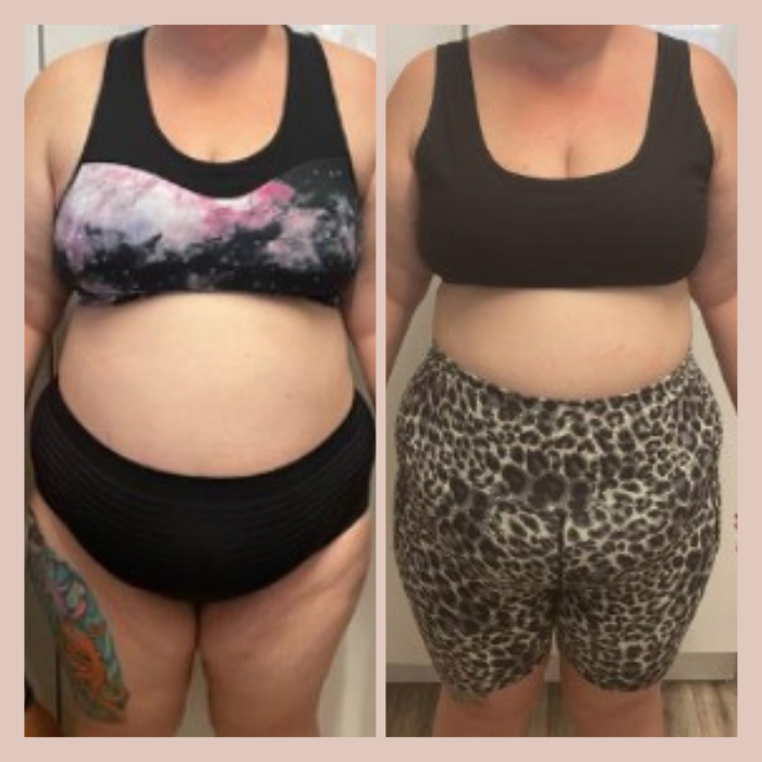 Side-by-side comparison of a woman before and after weight loss, showing her torso, wearing different outfits in each photo.