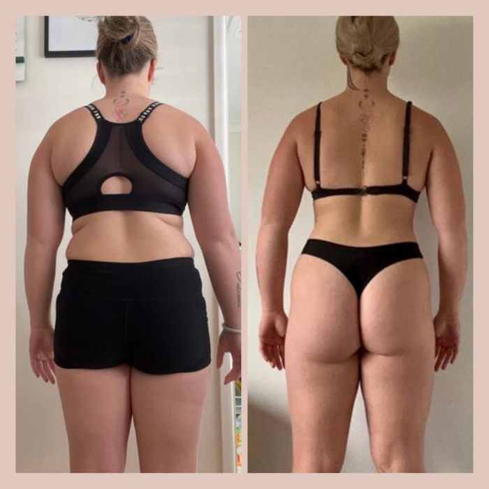 Side-by-side photos of a woman showing her back, with noticeable physical transformation from a larger to a slimmer physique.