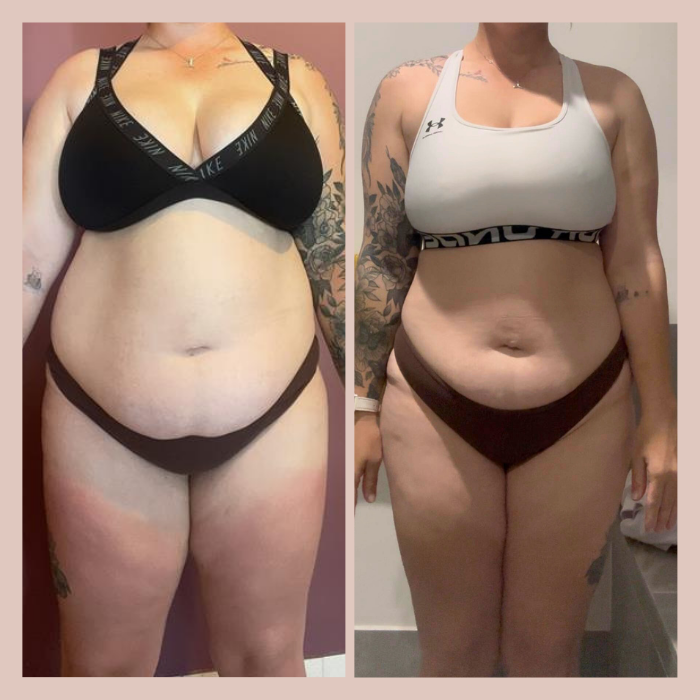 Side-by-side comparison of a woman's body before and after weight loss, wearing sports bras and underwear.