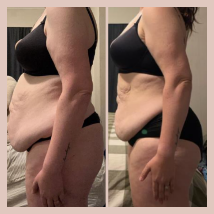 Side-by-side comparison of a woman showing physical transformation in her abdominal area, wearing black underwear and a black sports bra.