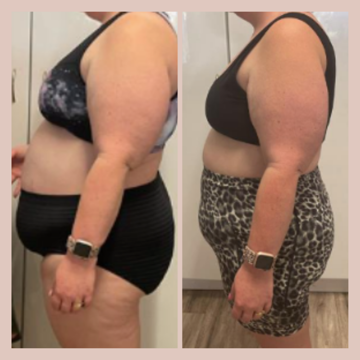 Side-by-side comparison of a woman before and after weight loss. In the left image, she wears a black sports bra and black striped shorts, with more body weight and visible fat. In the right image, she wears a black top and leopard print shorts, showing reduced body fat and a slimmer physique.