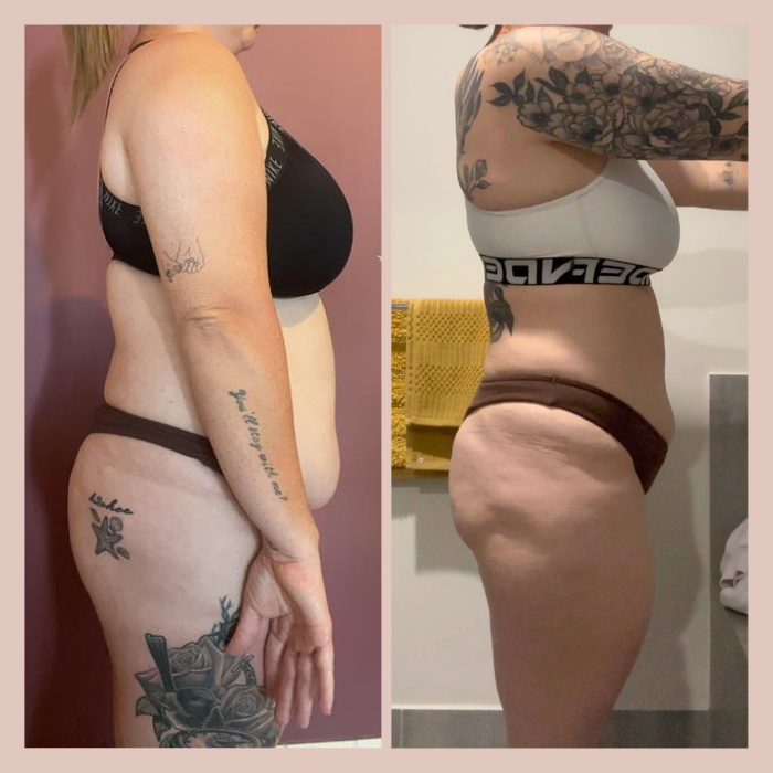 Side-by-side comparison of a woman's body before and after weight loss or fitness transformation, showing significant reduction in body size and improved skin tone.