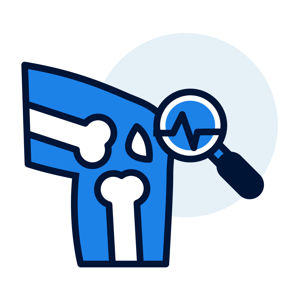 Illustration of a human knee with bones visible, accompanied by a magnifying glass showing a heartbeat line, indicating medical or health analysis related to knee health.
