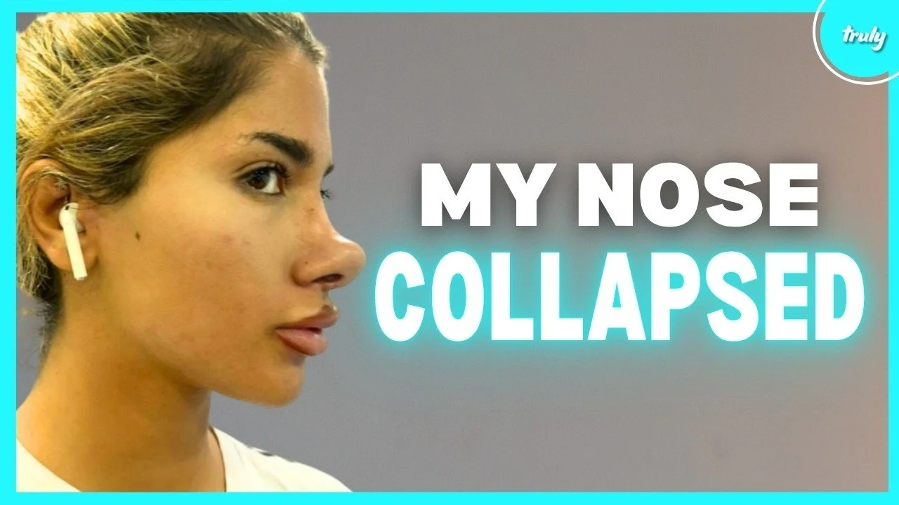 £18K on nose job.jpg