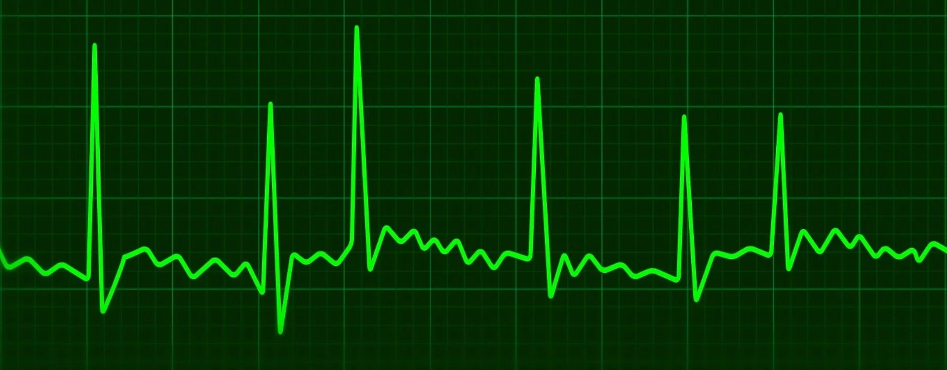 New guide: Irregular heartbeat — what does it mean?