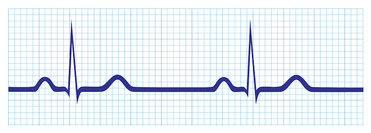 ECG-style illustration of a normal, regular heart rhythm