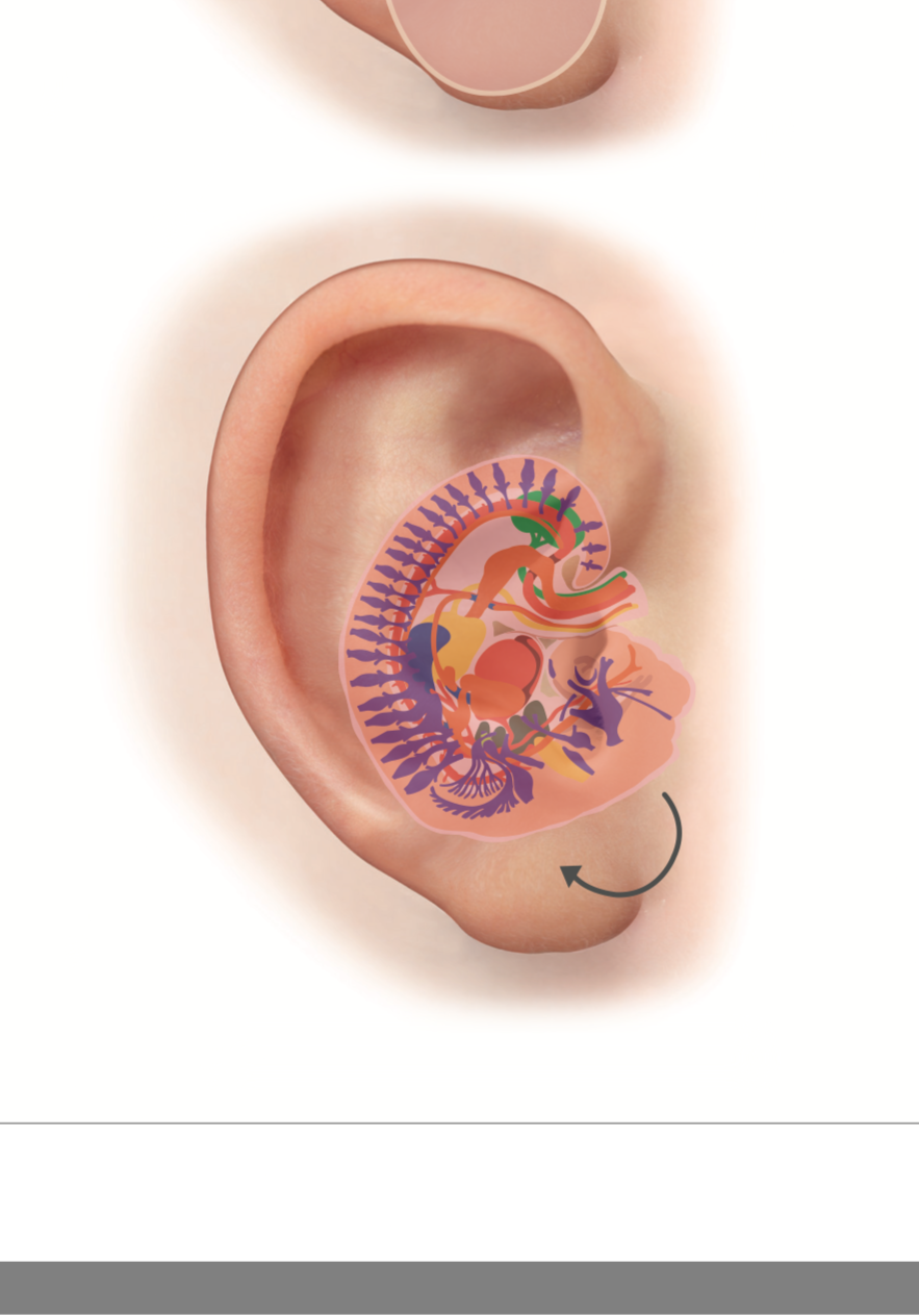 Grafik eines menschlichen Ohrs mit einer inneren Anatomieillustration, die die Gehörknöchelchen, den Innenohr und die Nerven zeigt.