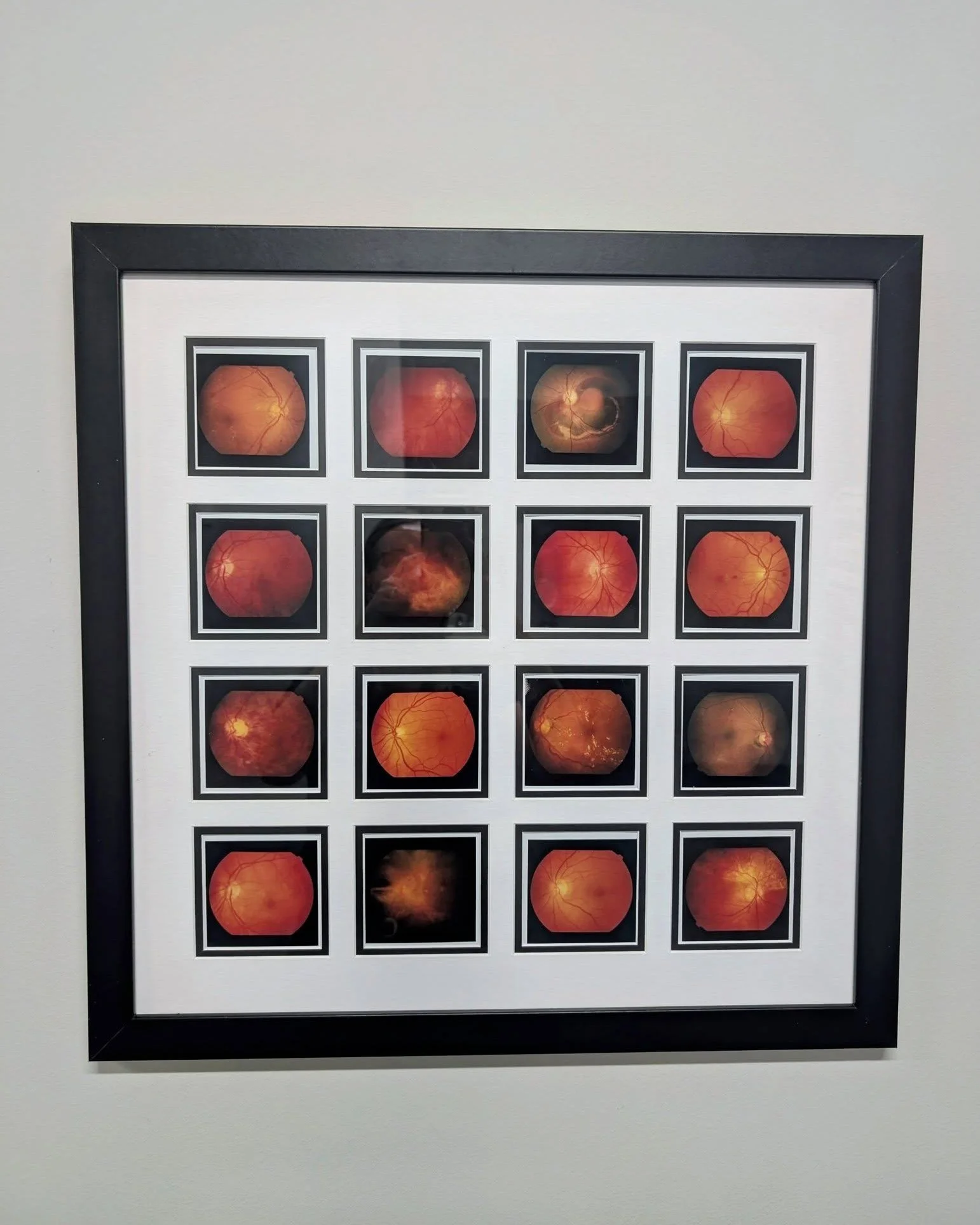 Keep your eyes peeled for some new artwork in the office. 👀 Dr. Stoffel discovered these retinal fundus photos tucked away when she bought the practice &mdash; original Polaroids from the late 80's that had been in storage. Each image captures the b