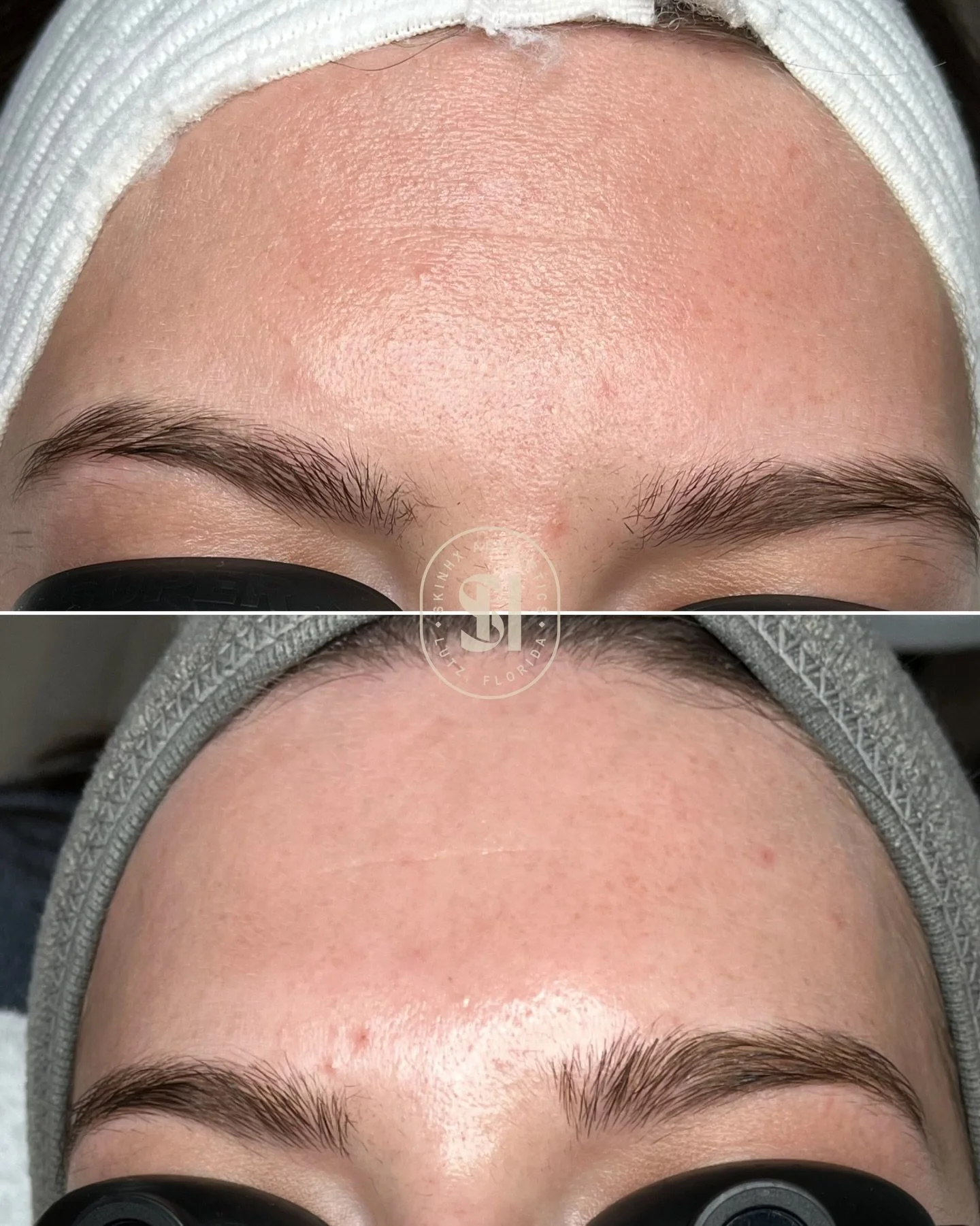 Does anyone else feel like their skin just starts looking tired, textured, or dull no matter how much skincare they use? ☁️

Honestly, this is so common. Many people are using good products at home, but sometimes the skin needs a few adjustments, mor