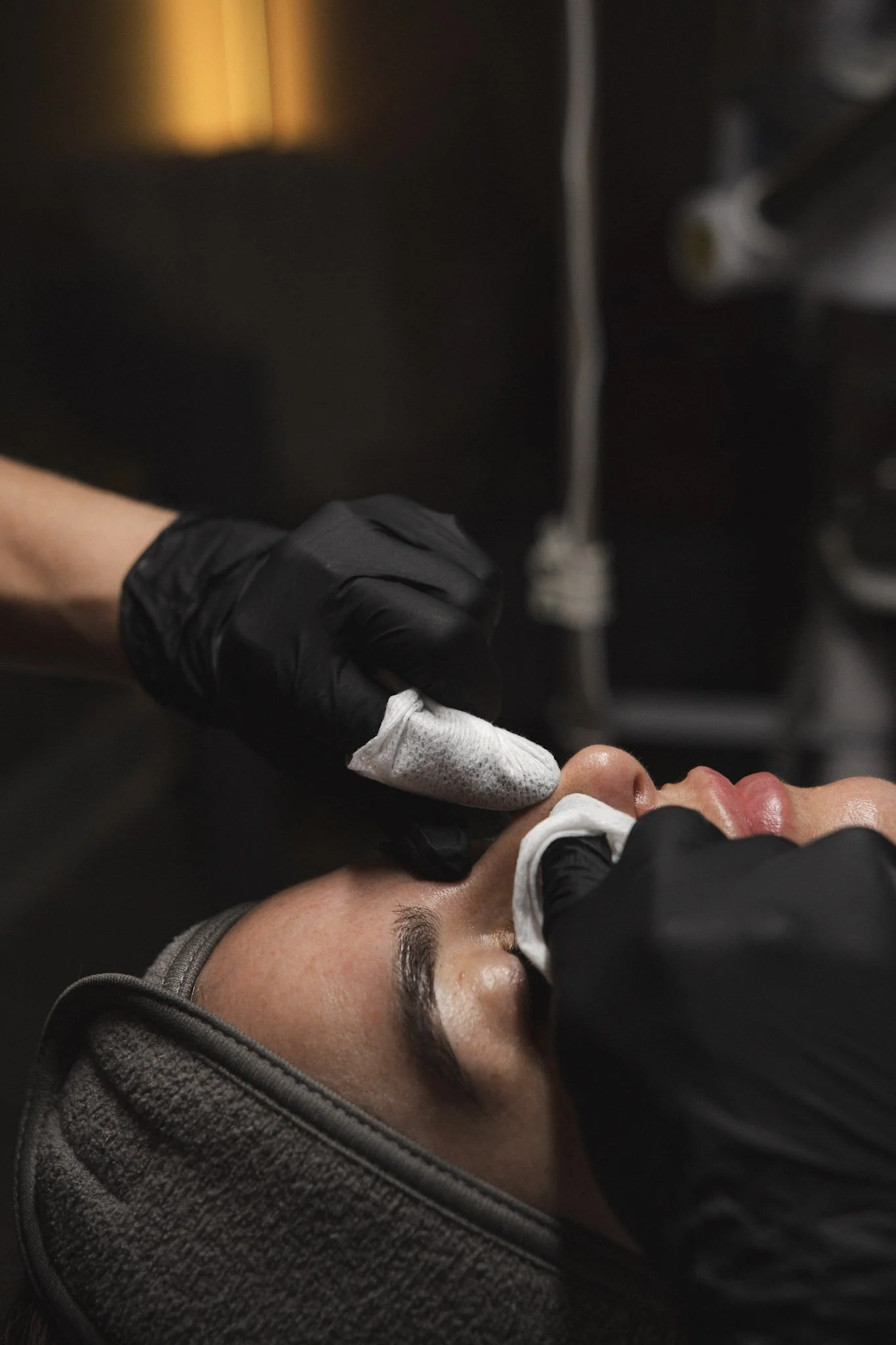 acne facials in tampa