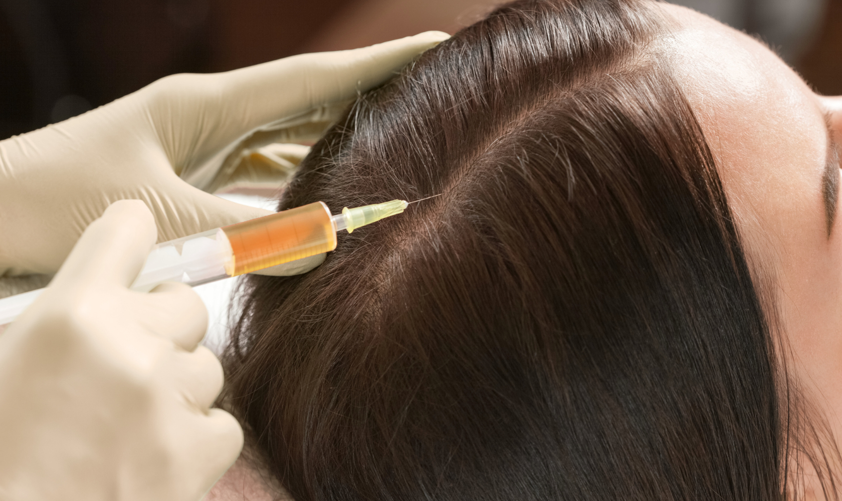 Medspa in Tucson, AZ, 85718 PRP Hair Restoration Near Me.png