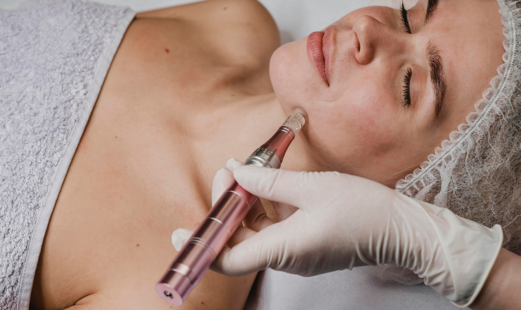 Medspa in Tucson, AZ, 85718 PRP Microneedling Near Me.png