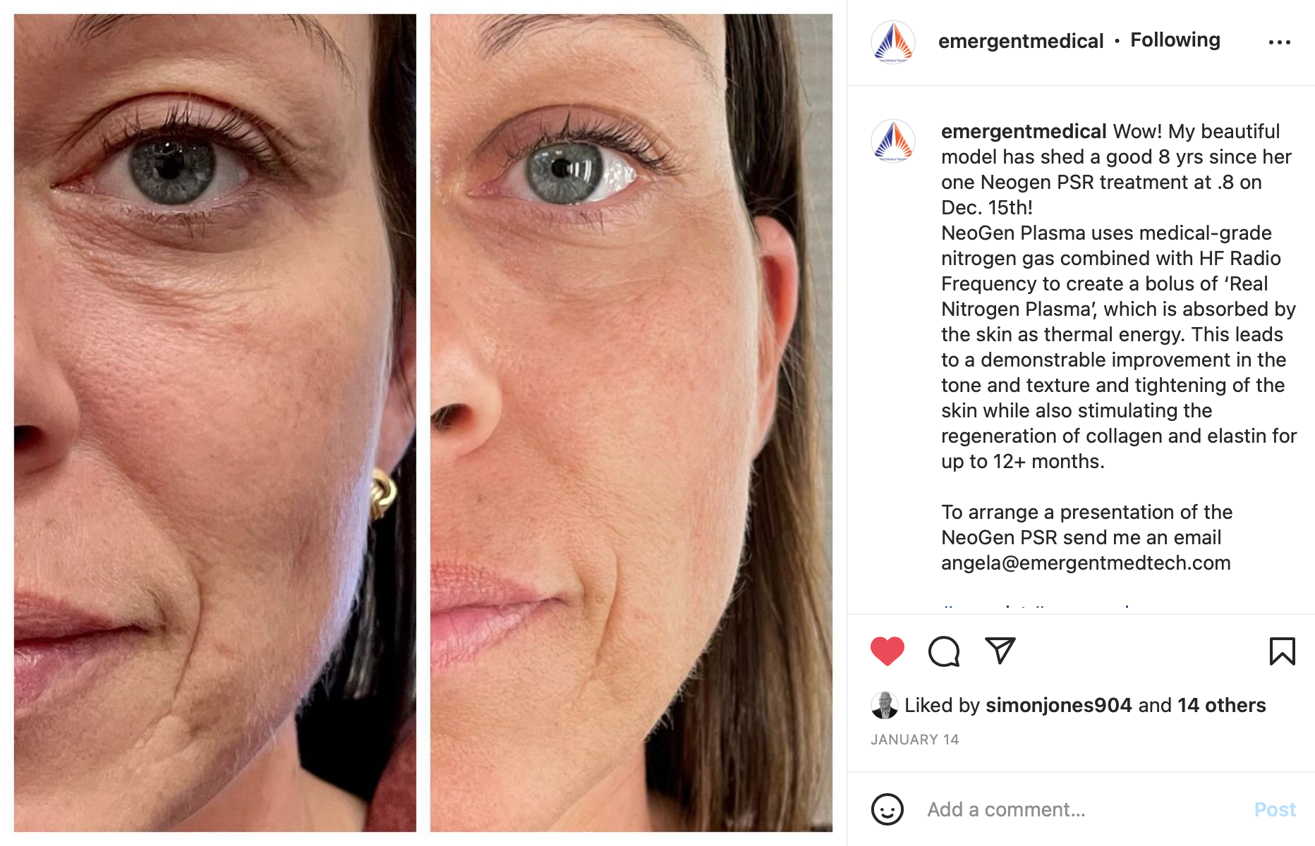 Screenshot 2022-01-27 at 09.12.36.png