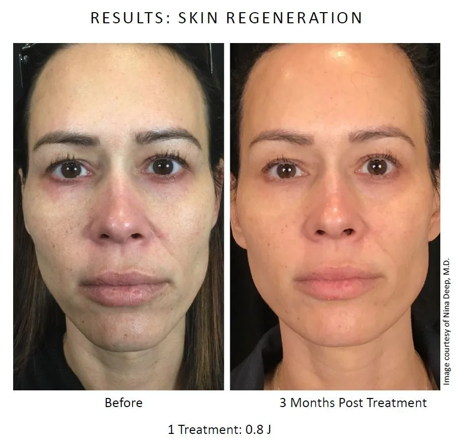 Nina Deep 0.8j (4).jpg