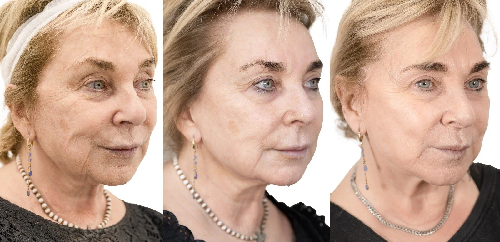 2023-03-06 17.27.39.jpg