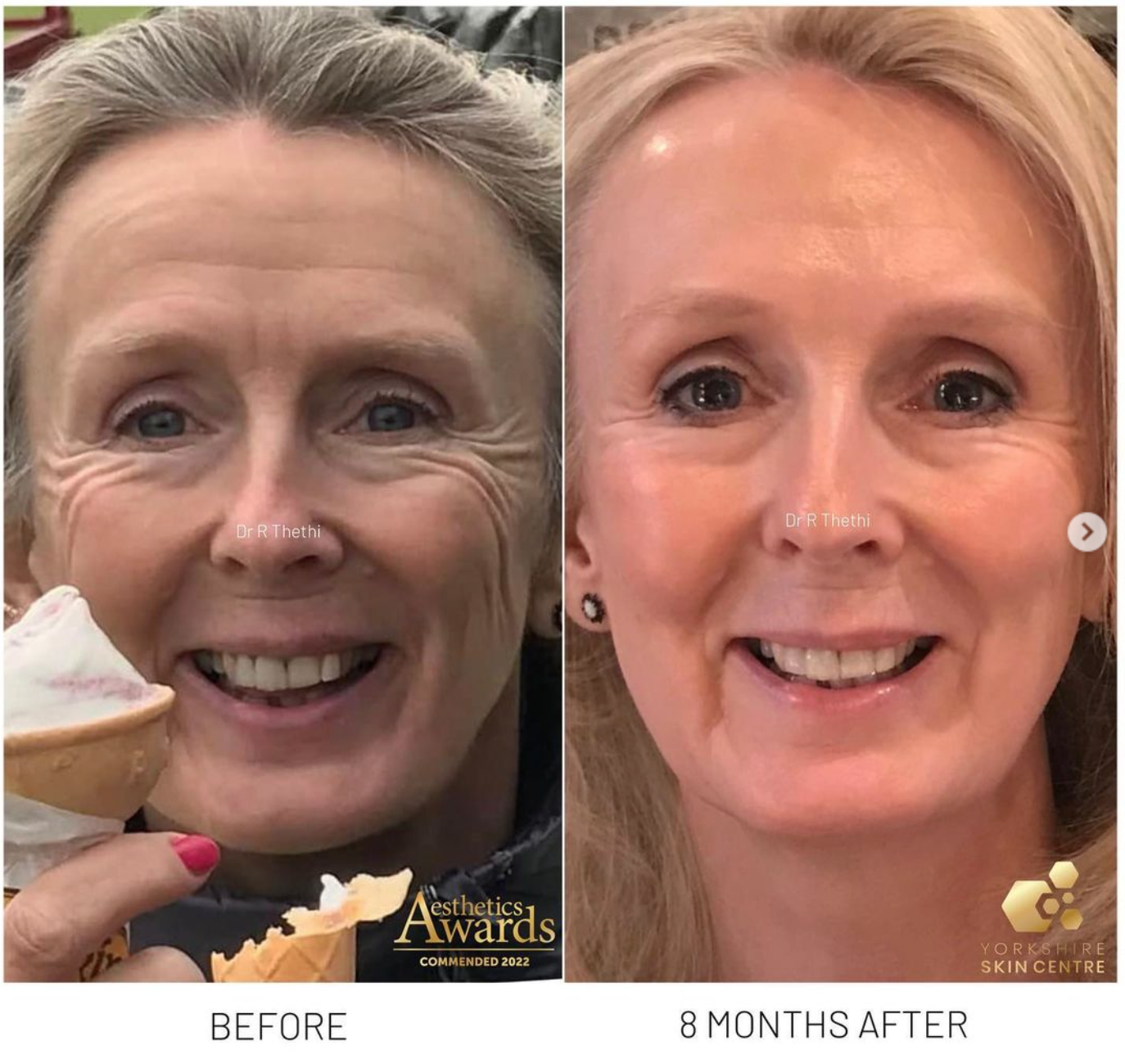 Dr Raj Thethi YSC 3.png