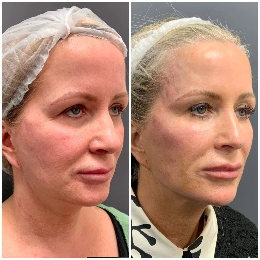 PHOTO-2023-06-20-15-14-24 5.jpg