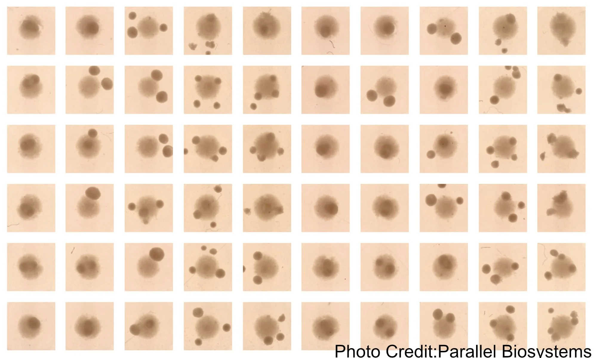 Parallel Bio's Expansion into Therapeutics, and We're Looking Out for More Potential Cash Flow Challenges -Watertown Bio News RoundUp