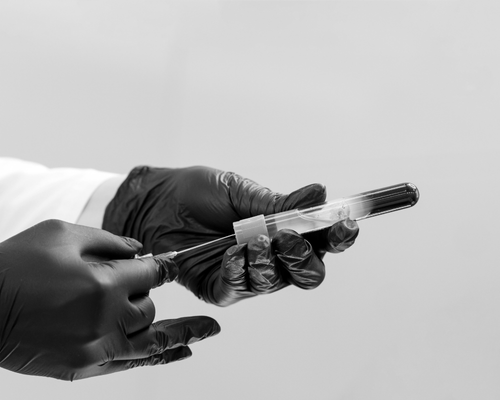 Close-up of gloved hands preparing PRP treatment.