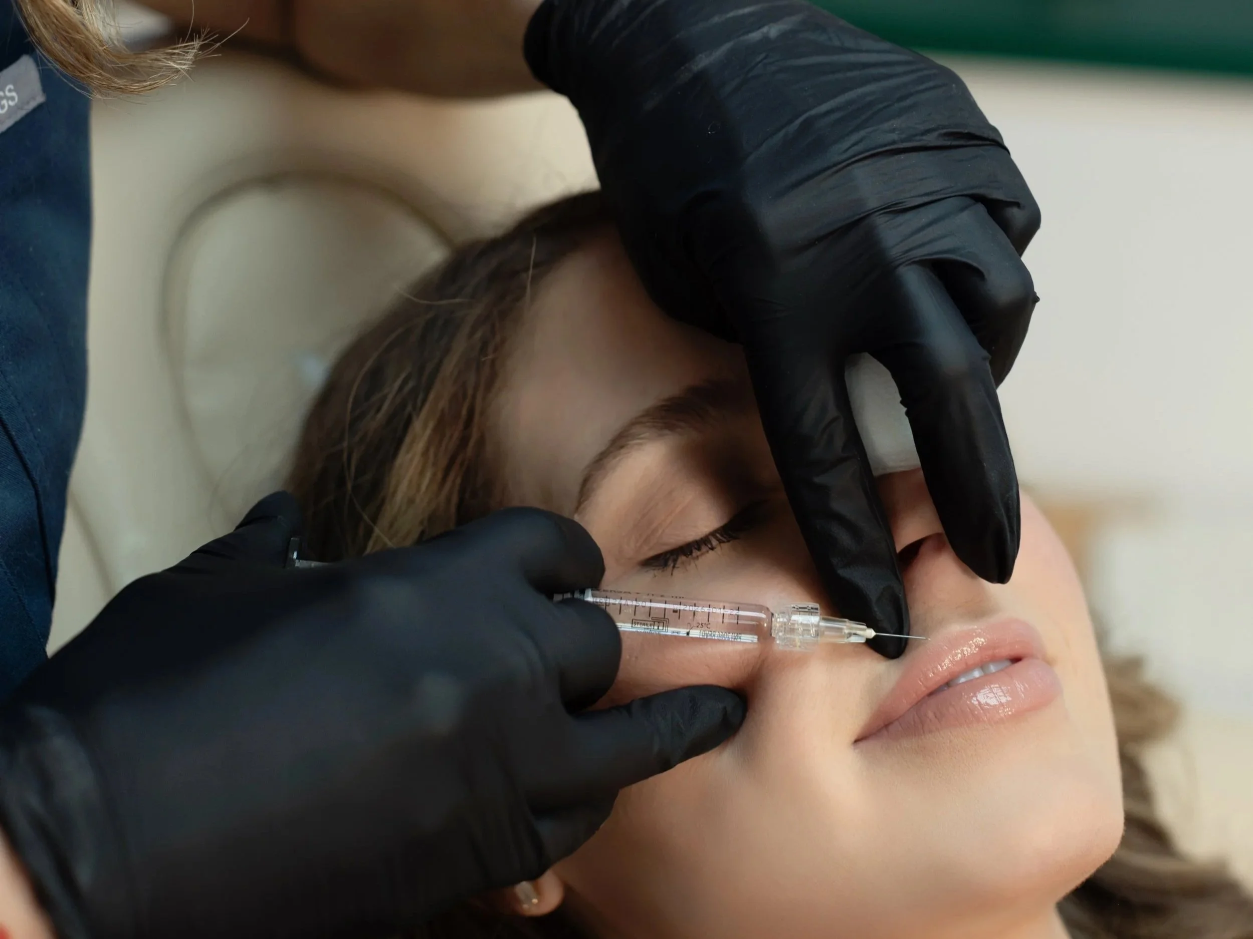 A Regenerative Approach to Lip Filler