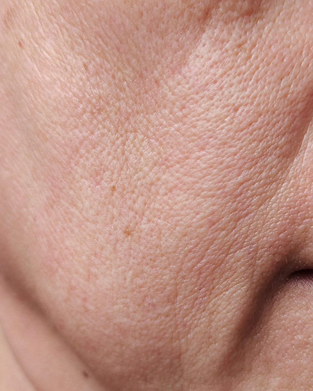 Close-up of human skin showing pores and fine hair on cheek and jawline.