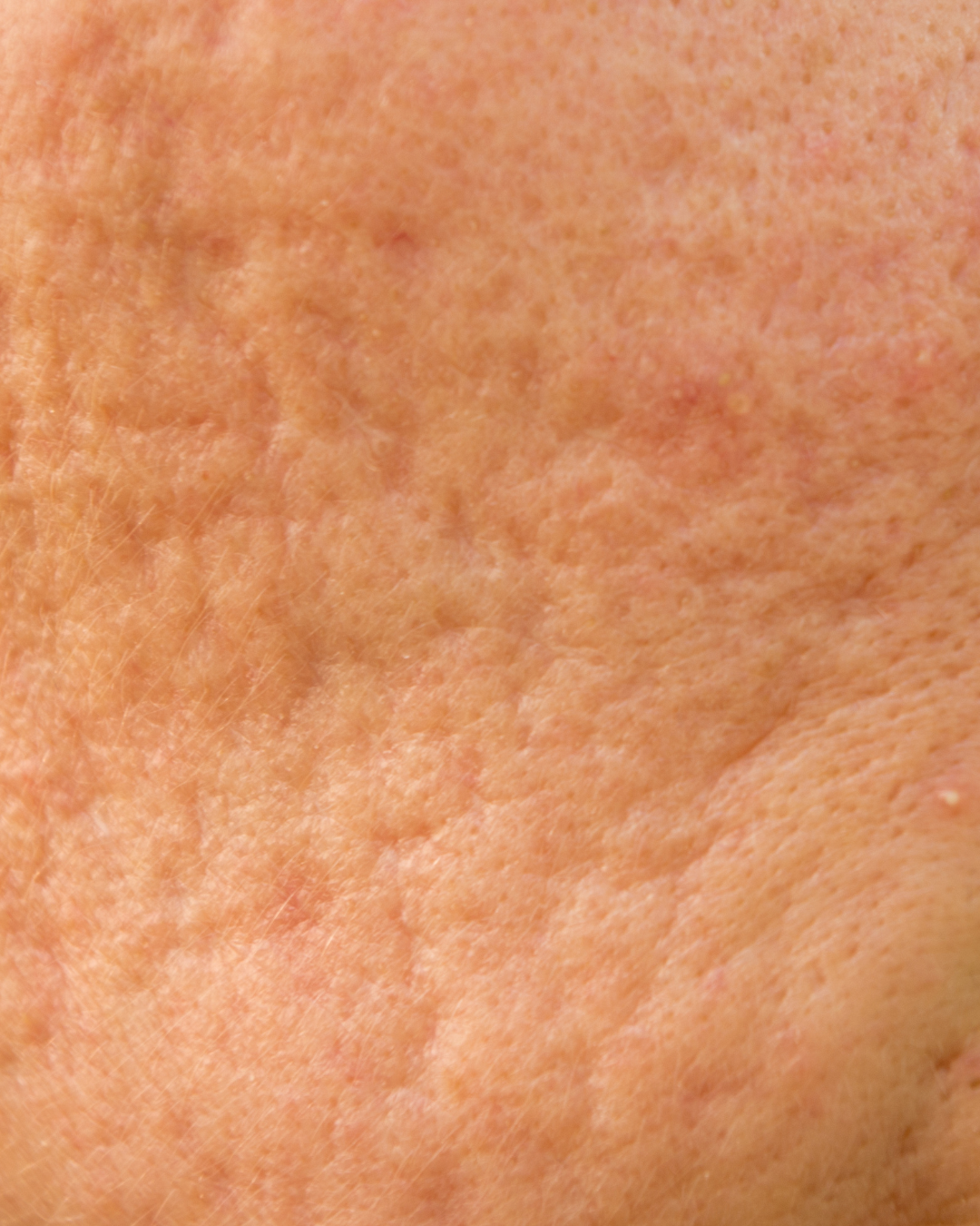 Close-up of human skin showing texture and pores.