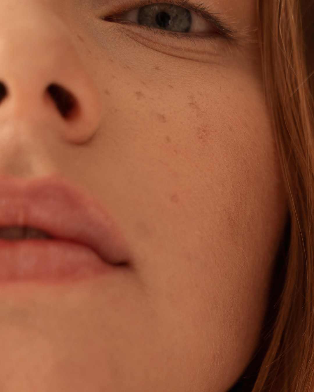 Close-up of a person's face showing a partial view of an eye, nose, and lips with freckles and reddish hair.