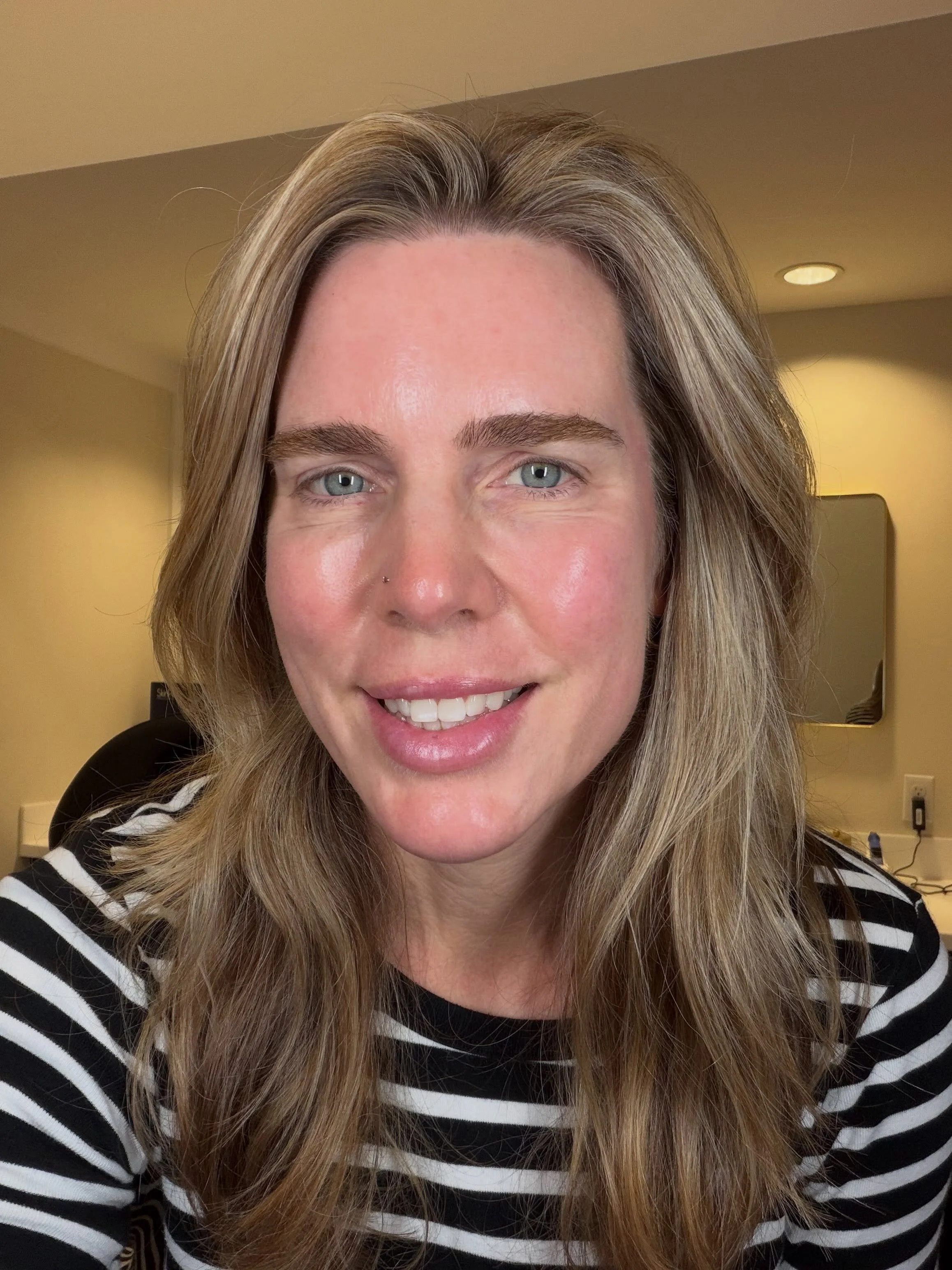 No filter. No makeup. Just a little fall refresh 🍁 

I don&rsquo;t recommend anything to patients that I wouldn&rsquo;t do myself, so here&rsquo;s my own fall routine:

✨Light &amp; Bright which pairs IPL with Frax 1940 for improvement in both tone 