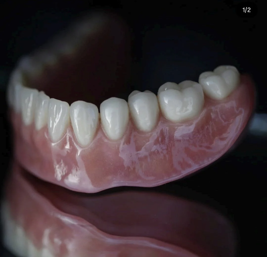 Complete Denture Arch  / Complete Denture Set