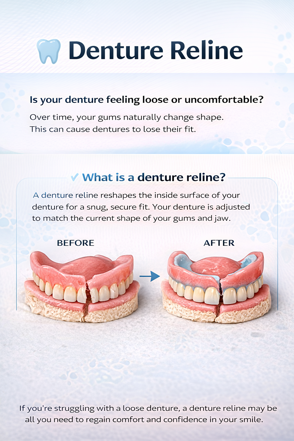 Denture Reline