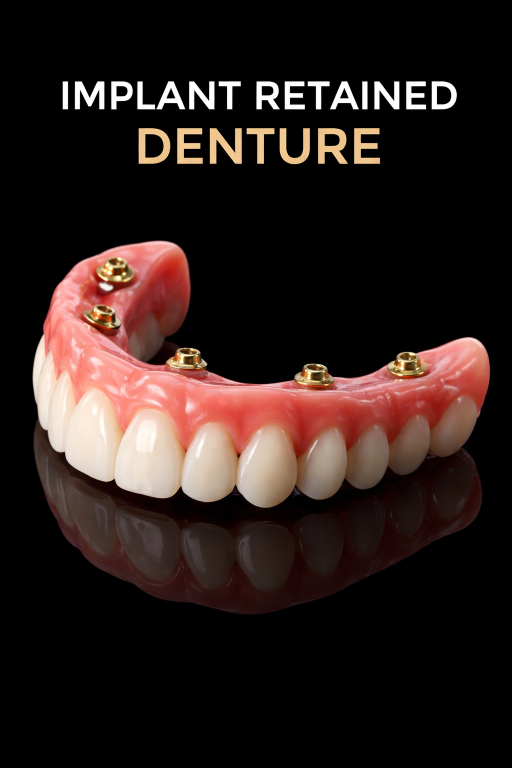 Implant Retained Dentures  (Replacement & New Prosthetics)