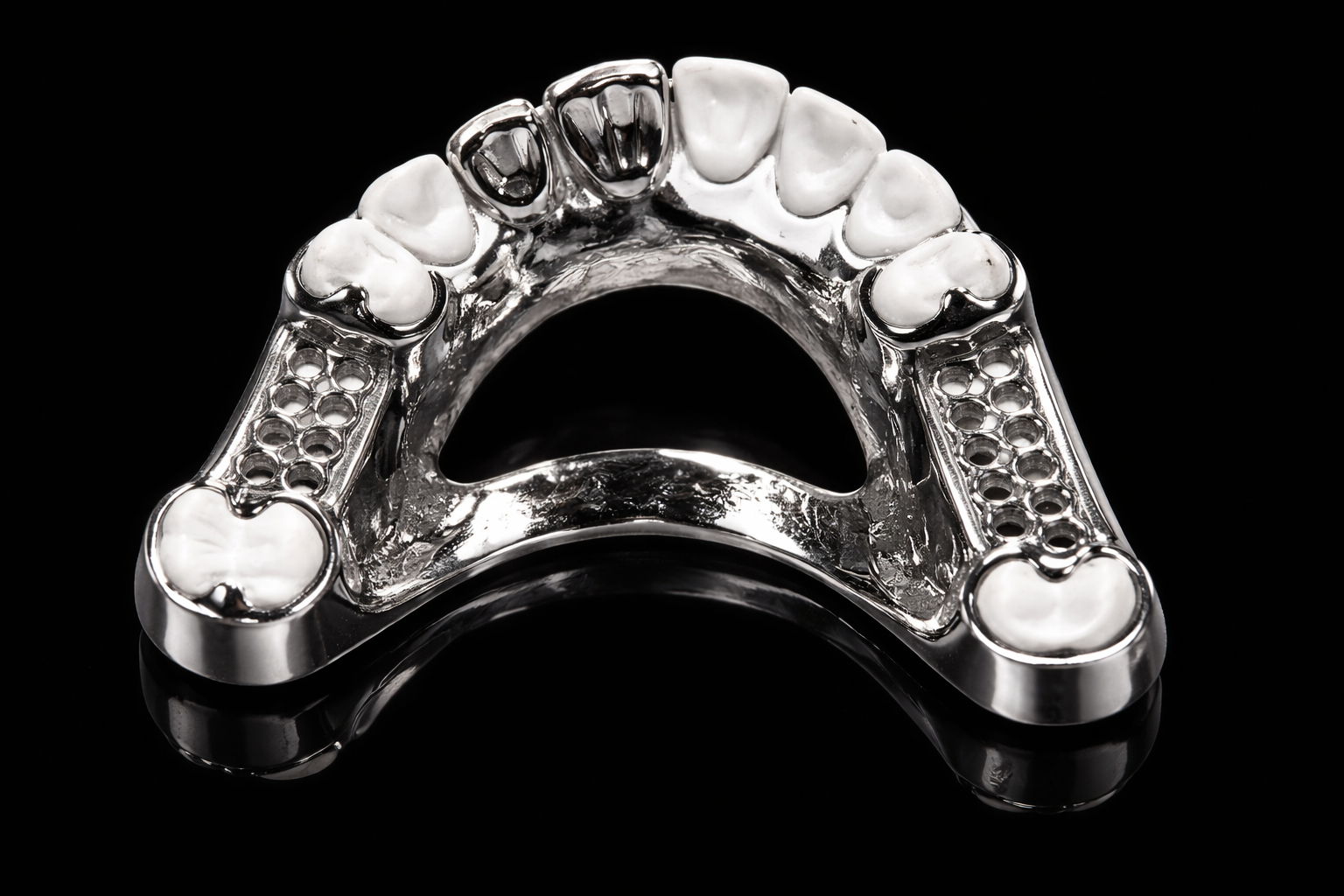 TItanium Denture Framework by Emilia Lesica Modern dentures chesterfield I UK craftsmanship prosthodontics I Private Denture Expert UK Derbyshire