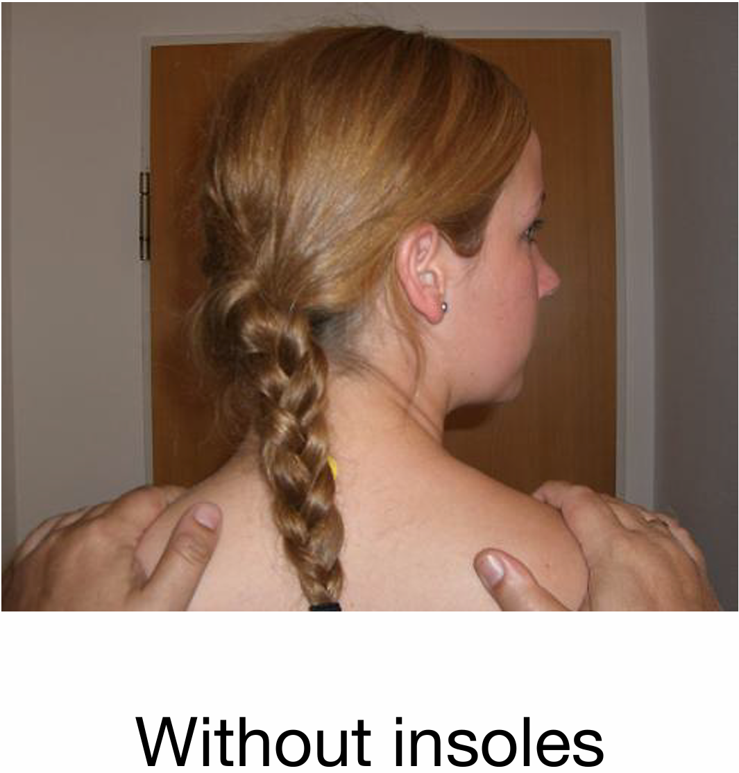 Side view of a woman with red hair in a braid, receiving a shoulder massage, with the caption 'Without insoles'.