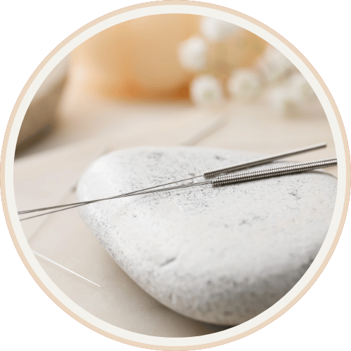 Acupuncture needles resting on a smooth white stone, representing traditional acupuncture treatment at Current Wellness in Portland, OR