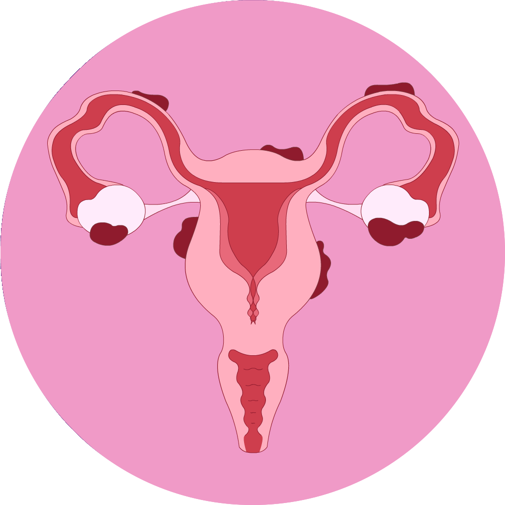 Endometriosis Manager