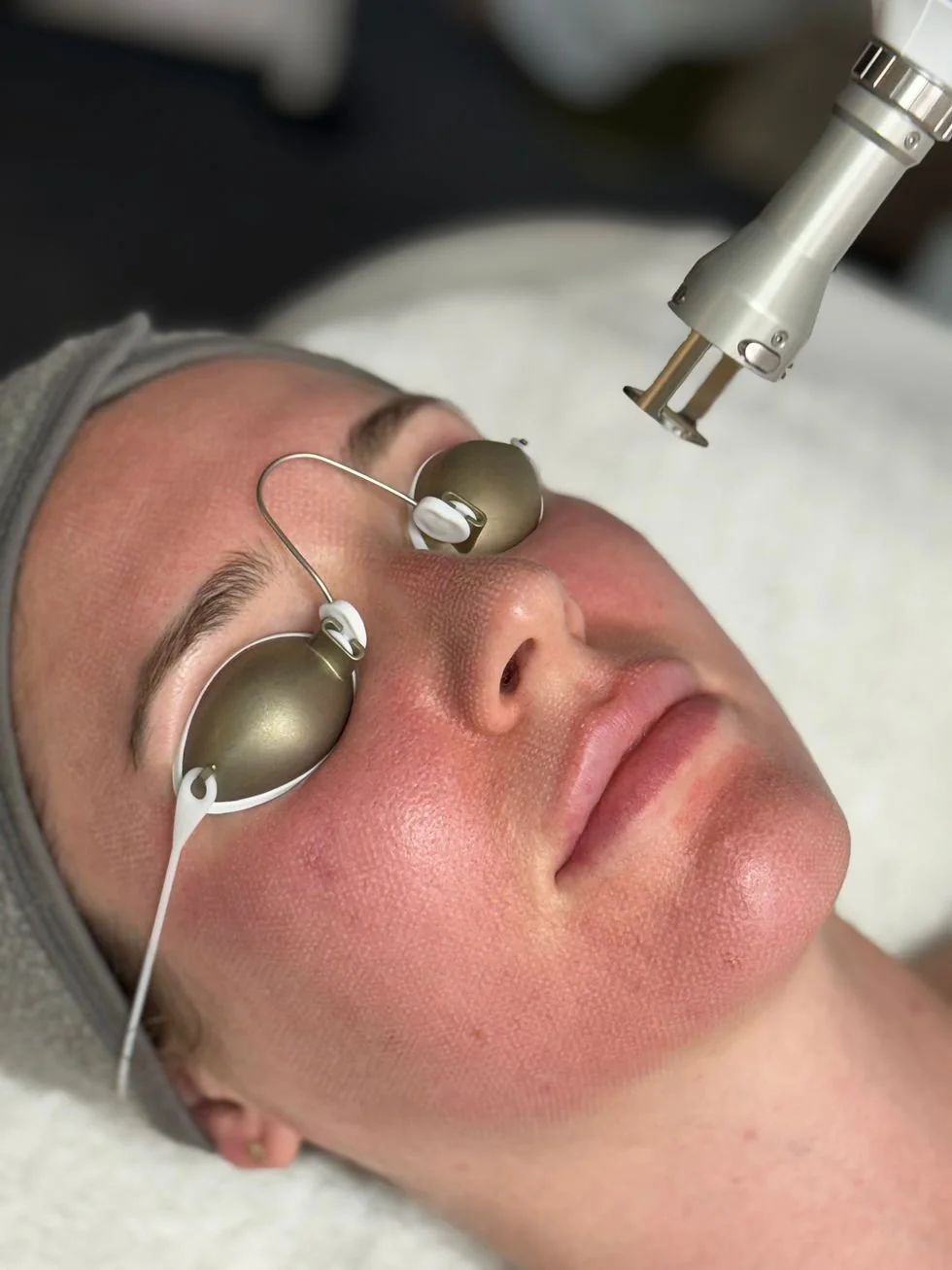 A woman undergoing a facial treatment at a skincare clinic, with metallic eye masks and a close-up of her face during the procedure.