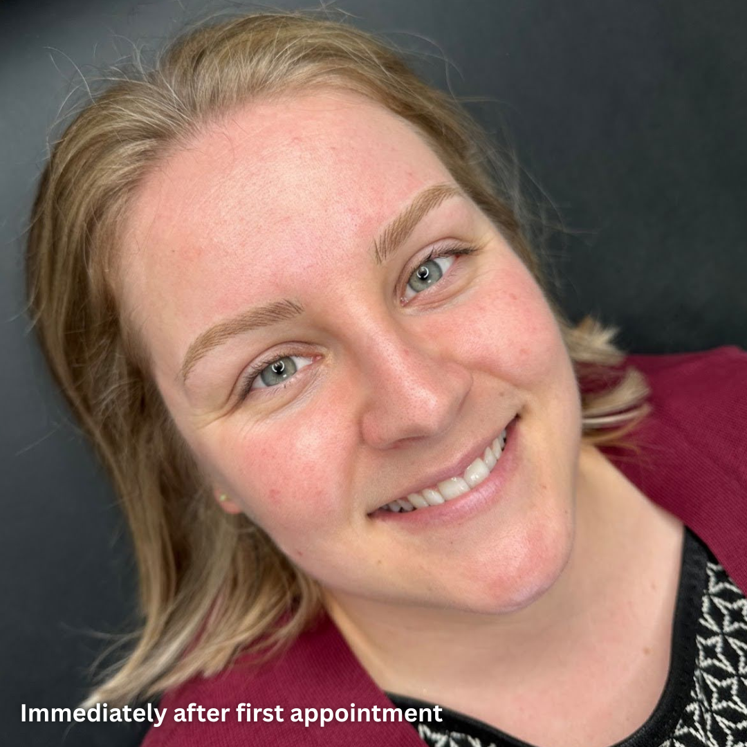 Nano Brows Immediately after first appointment at Studio M Aesthetics.