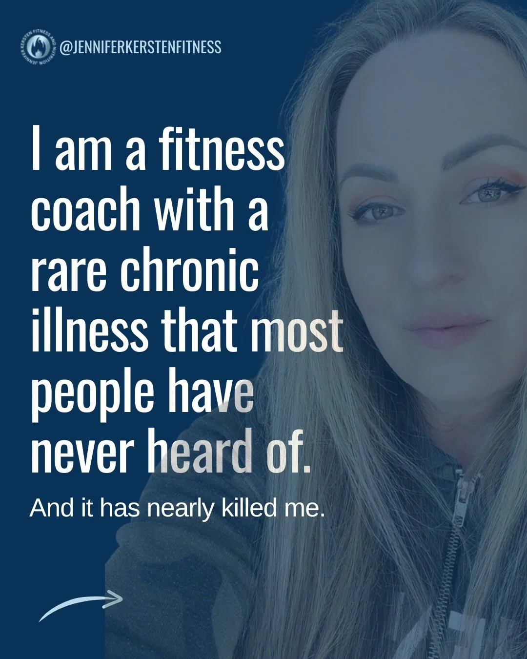 If you are navigating health complications while still trying to show up for your fitness goals, I relate to this on a deeply personal level. 

I have had to restructure my entire life and the way I do things to be the fit woman I want to be in a bod
