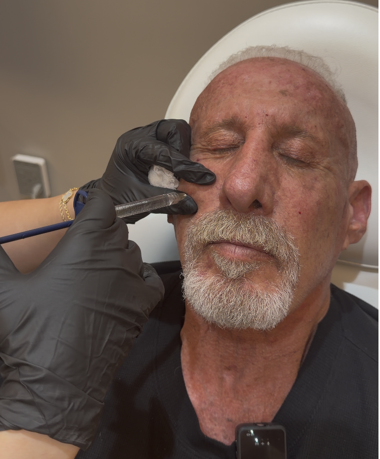 A man receiving a cosmetic injection in his forehead from a healthcare professional wearing black gloves.