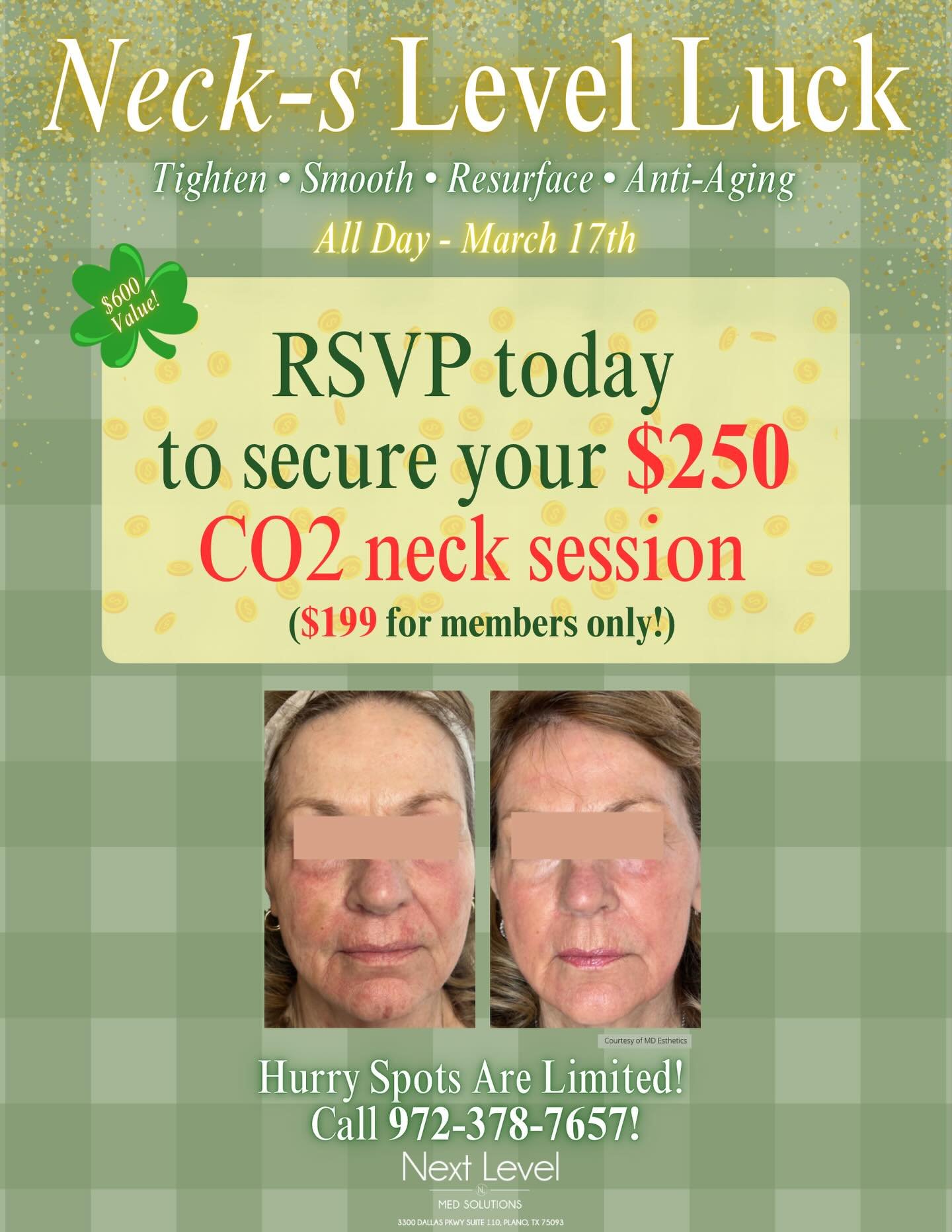 Your Spring Break Glow Starts Here ☘️✨

Lucky you &mdash; our CO₂ Neck Treatment Event is March 17th! Tighten, smooth and refresh your skin just in time for spring break and the summer!

🤍 $250 CO₂ Neck Session
💚 Members Only: $199

Hurry! All spot