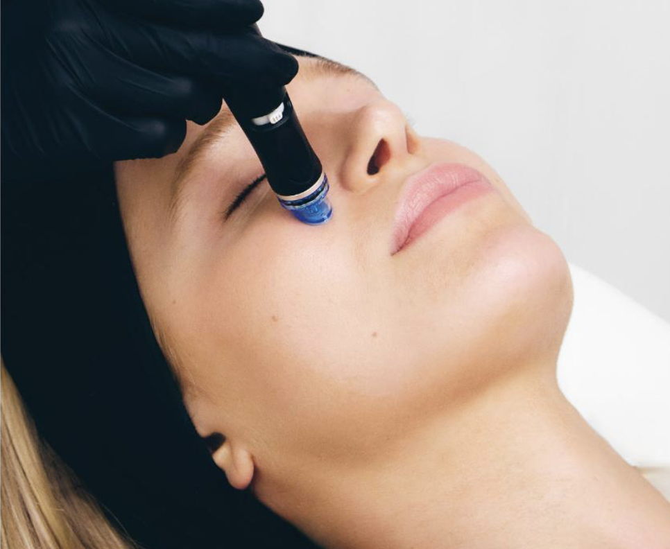A woman receives a HydraFacial treatment on her face with a HydraFacial handpiece, while lying down with her eyes closed and a professional in blue gloves performs the treatment.