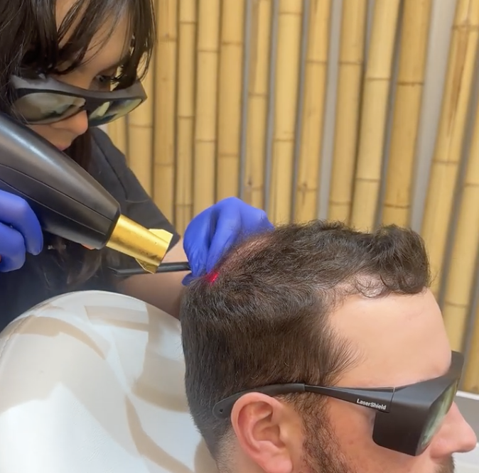 Non-Surgical Hair Rejuvenation 