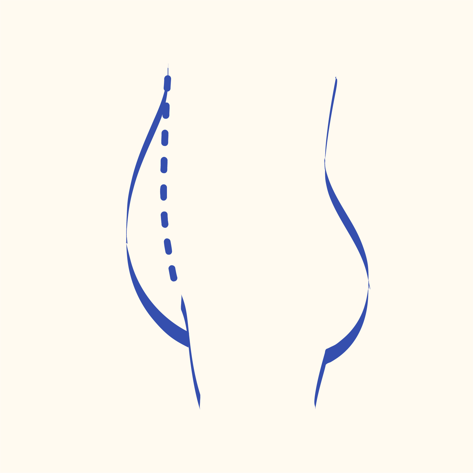 decorative - tummy tuck icon