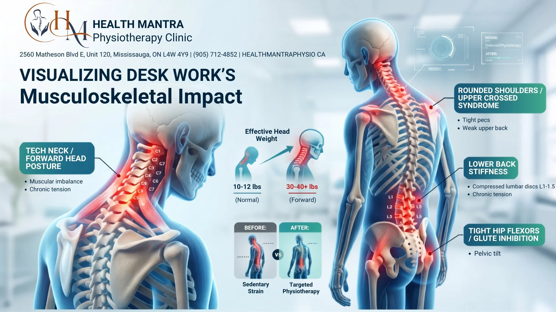 Desk Worker Pain: Why Your Neck and Lower Back Hurt                     (And How Physiotherapy Fixes It)