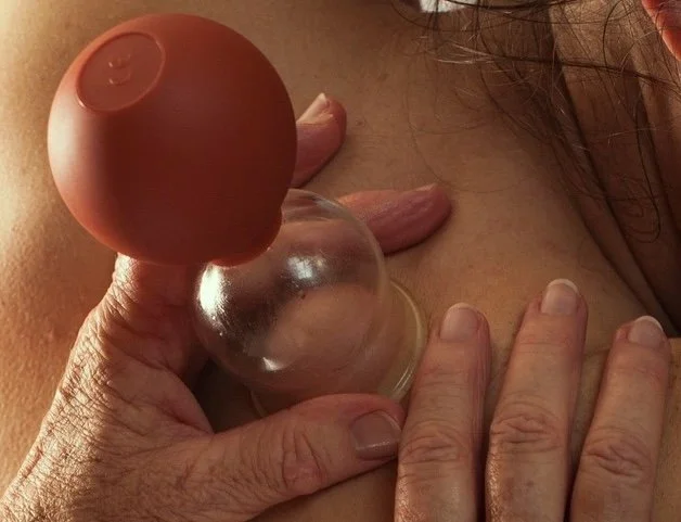 Die Heilpädagogin wendet eine Schröpfbehandlung bei einer Kundin an – eine traditionelle Methode zur Förderung der Durchblutung und Lösung von Verspannungen.