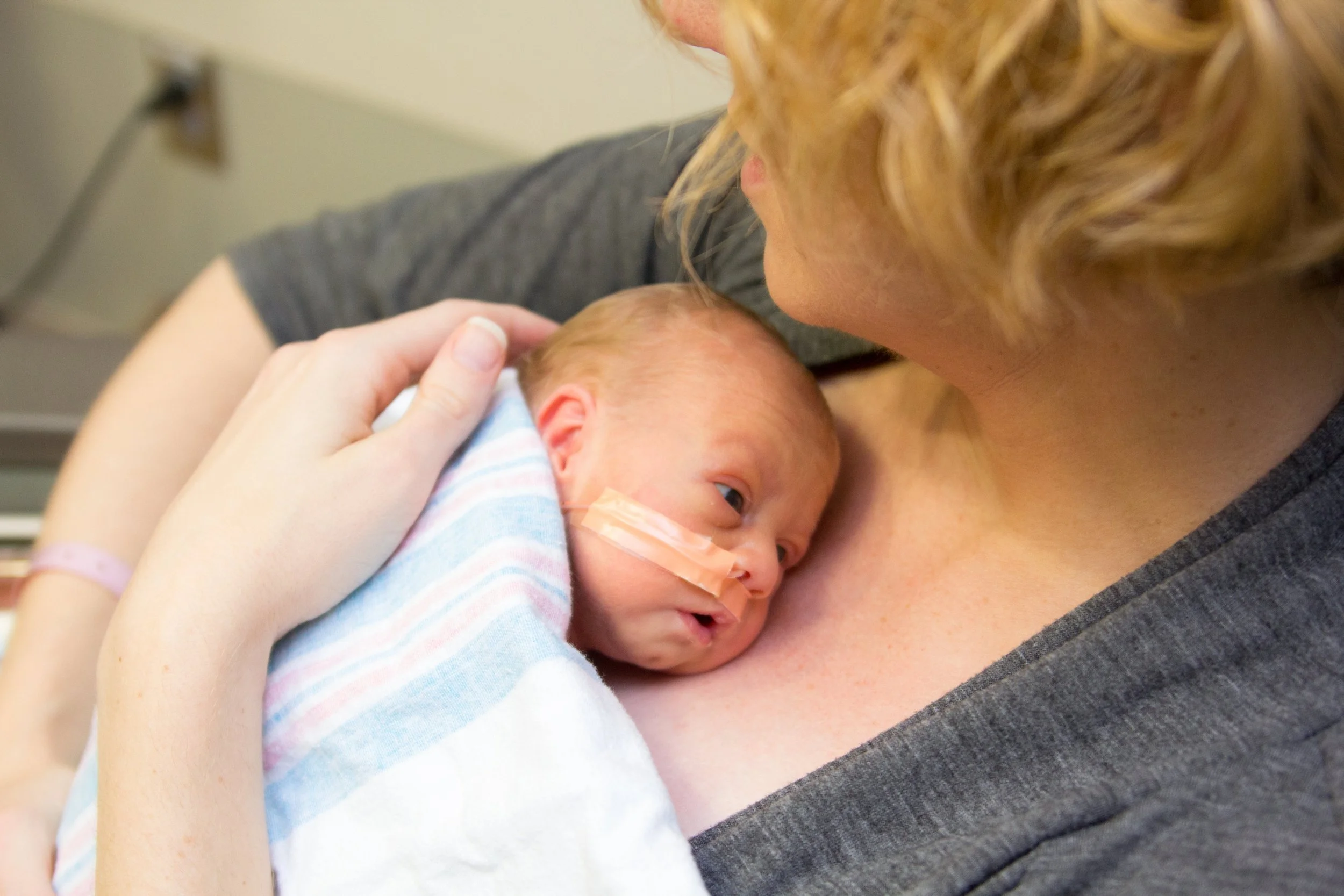 When Premature Birth Might Be a Good Thing