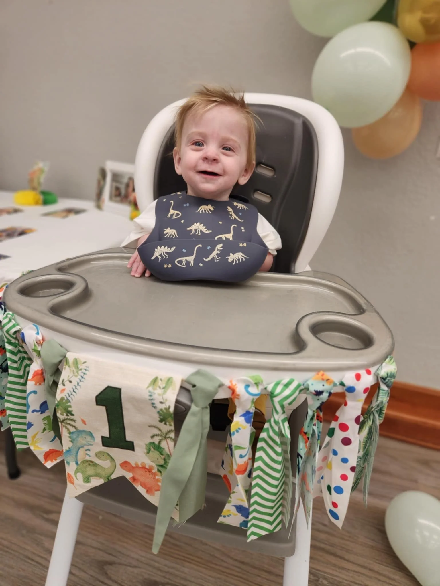 Gastroschisis Defect